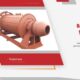 Jual Ball Mill